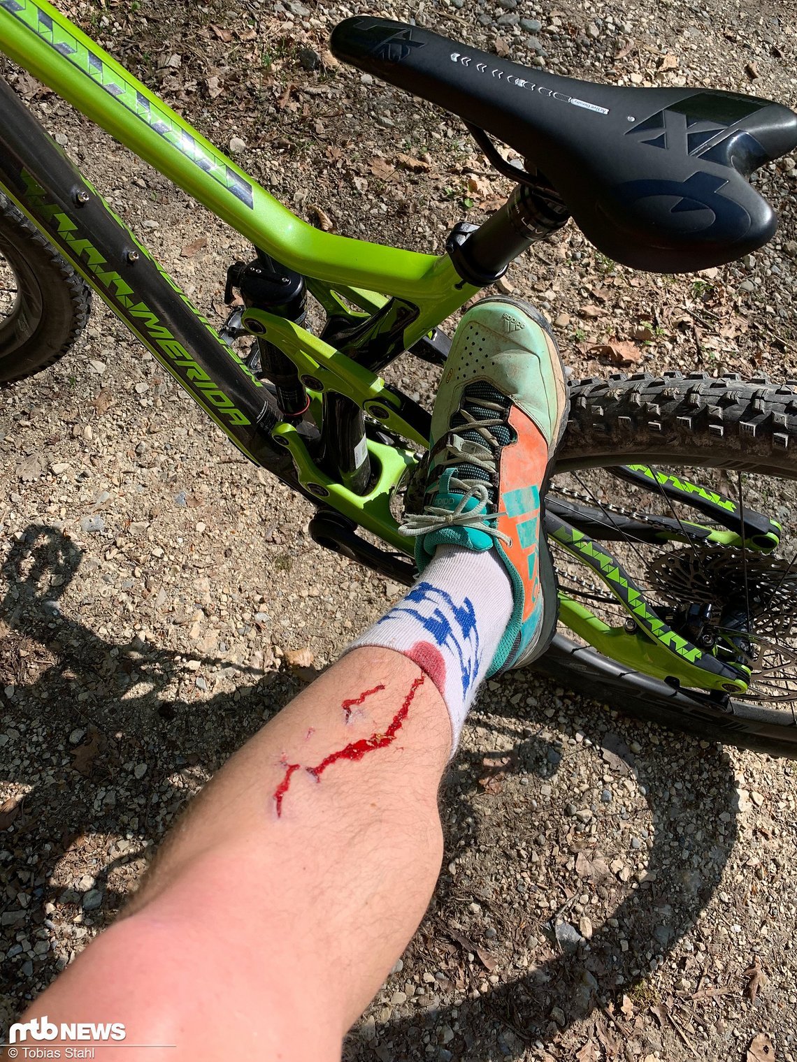 Irgendwann erwischt es jeden, zumindest, wenn man das Pedal so lange fährt, wie ich in diesem Fall …