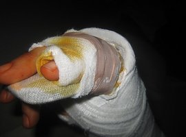 Foto