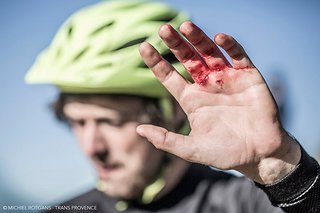 Die Erschöpfung macht sich bemerkbar – heute gab es einige Verletzte