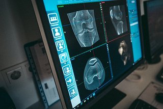 Die Diagnose kam für Alex Bregenzer sehr überraschend und traf ihn dafür um so härter Die Diagnose kam für Alex Bregenzer sehr überraschend und traf ihn dafür um so härter