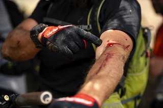 Mit steigender Renndauer steigt auch der Anteil derjenigen Fahrerinnen und Fahrer, die diverse Blessuren davongetragen haben.