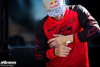 Wegen seines Sturzes auf dem Pumptrack war Tomas Slavik morgens noch beim Röntgen. Ergebnis waren zwei Absplitterungen im Handgelenk