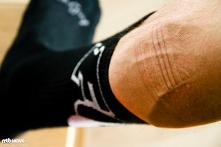 Nach einer Stunde Fahrt: Tiefe Abdrücke der Silikonstreifen auf der Innenseite der Schoner