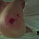 nachdemCrashbeimDropVitalis