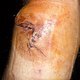knie 1