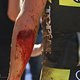 Kristian Hynek of Topeak Ergon Racing injured arm after a crash during stage 3 of the 2016 Absa Cape Epic Mountain Bike stage race held from Saronsberg Wine Estate in Tulbagh to the Cape Peninsula University of Technology in Wellington, South Africa 