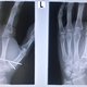hand 31.07