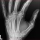 Hand 1
