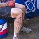 Rider with some battle scars cools down under the USN tent during a extremely hot Stage 3 of the 2025 Absa Cape Epic Mountain Bike stage race held at Fairview, Paarl, Cape Town, South Africa on the 19th March 2025. Photo by Dom Barnardt/Cape Epic
PLE