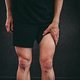 Ist man durch eine Verletzung gezwungen, die Beine stillzuhalten, leidet die Muskulatur sichtbar